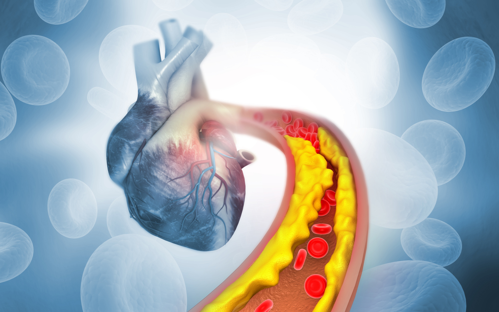 Heart With Cholesterol